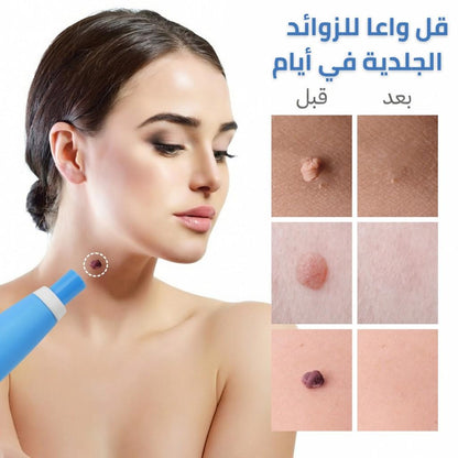 جهاز إزالة الزوائد الجلدية  249